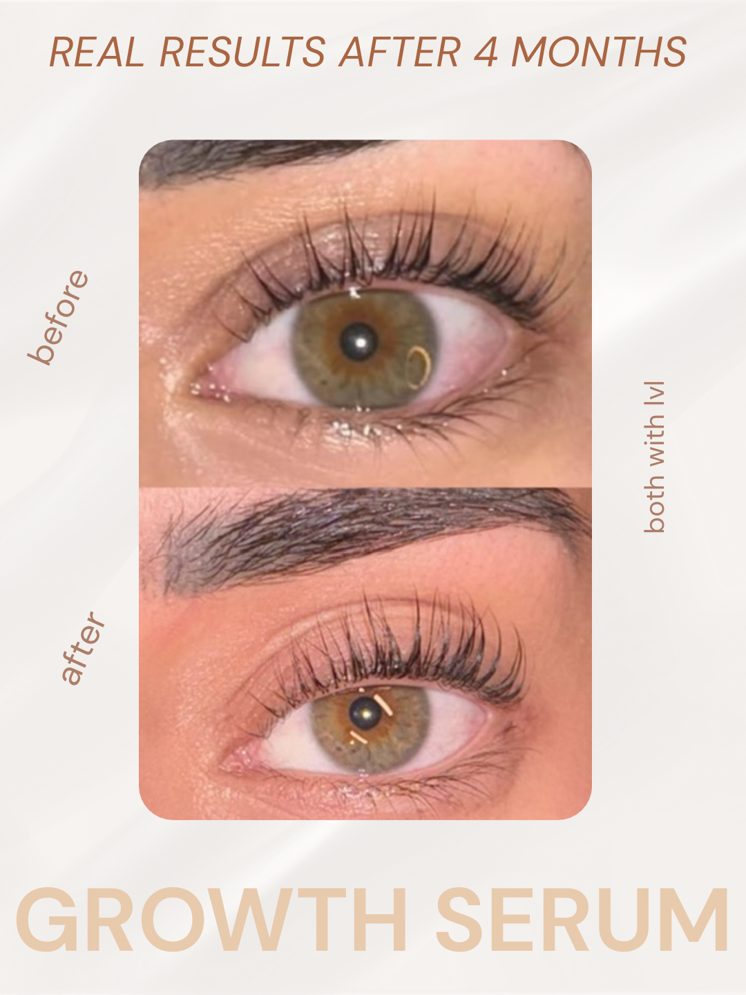 Eyelash Growth Serum