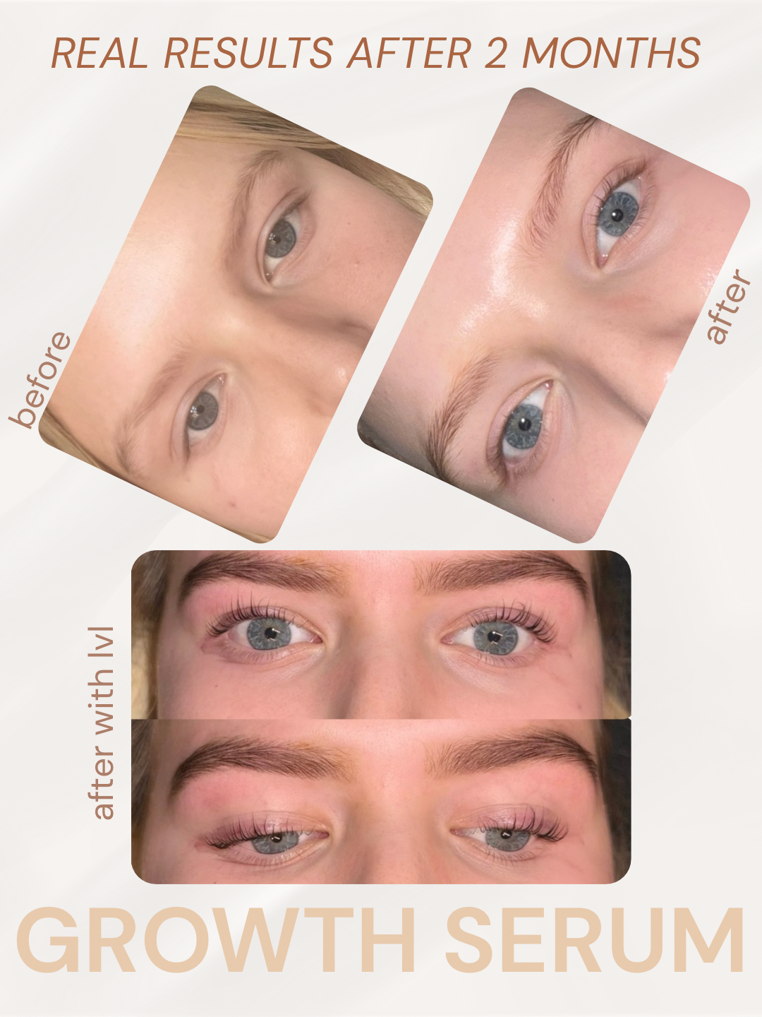 Eyelash Growth Serum